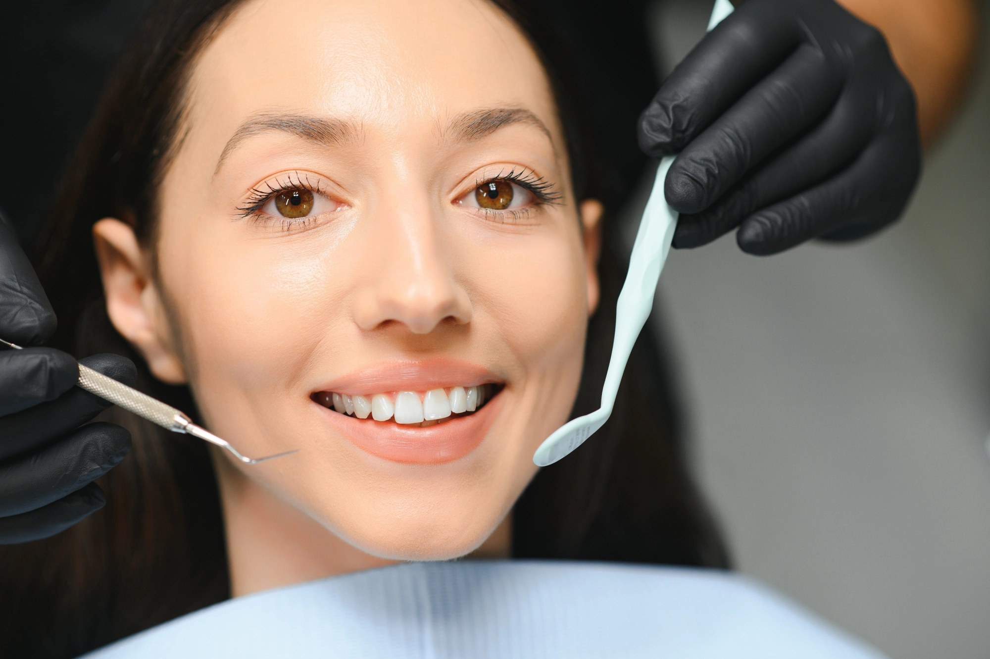Before Veneers, Consider Professional Teeth Whitening First