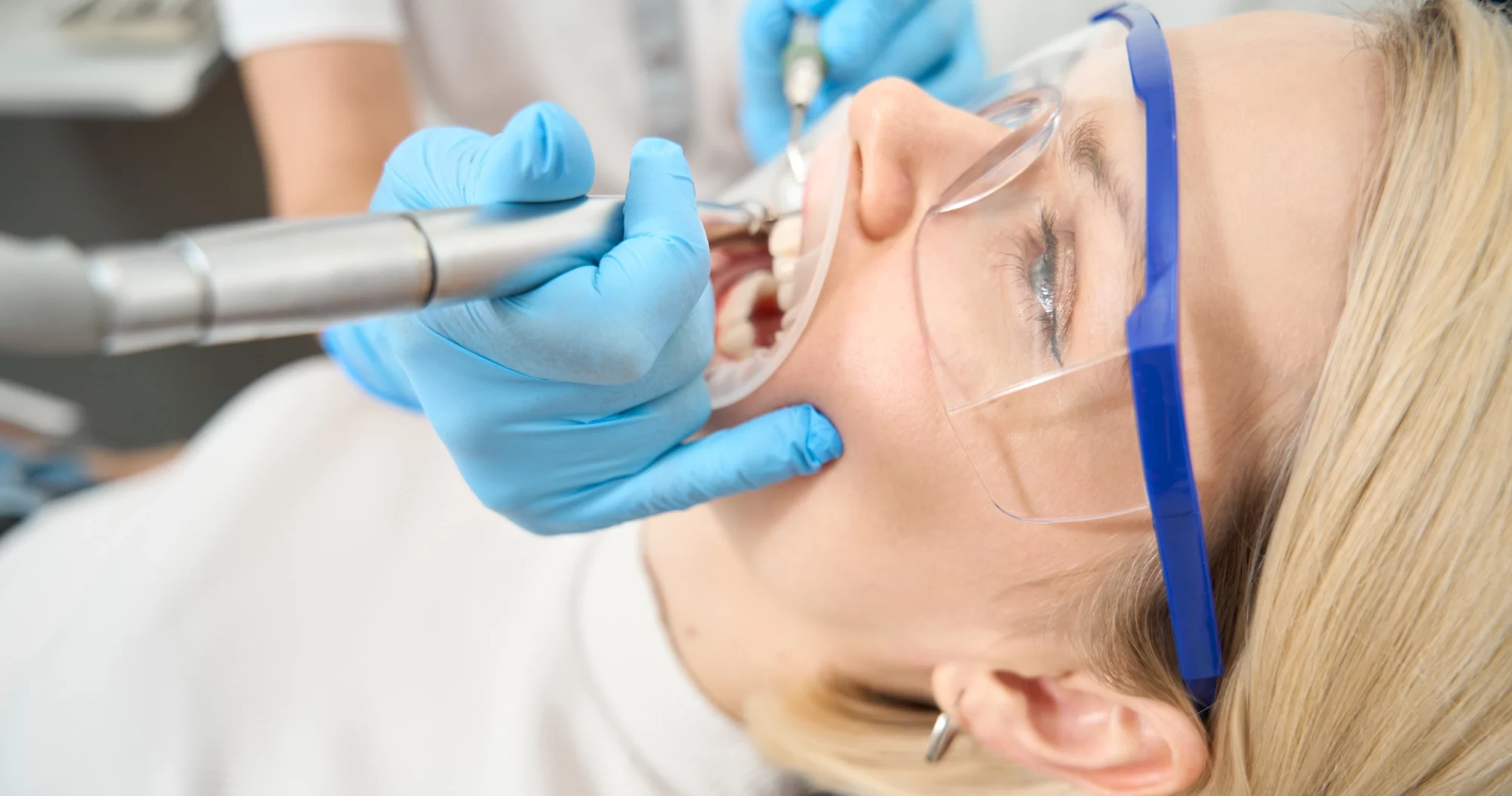 Understanding the Process and Purpose of Cavity Fillings