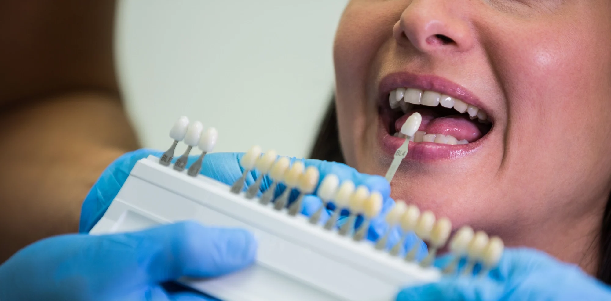 Getting a Crown on Your Tooth Is Easier Than Ever
