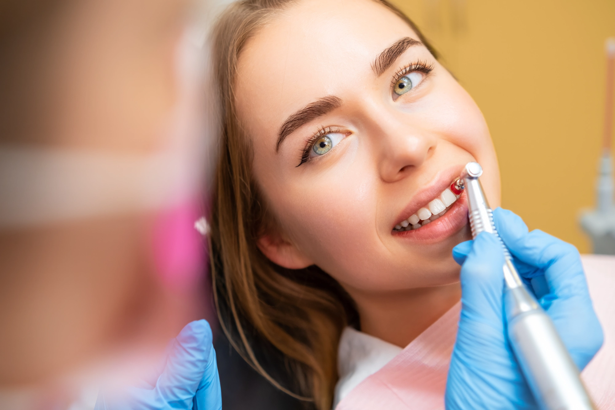 the tooth filling process_ quick, simple, and effective rest