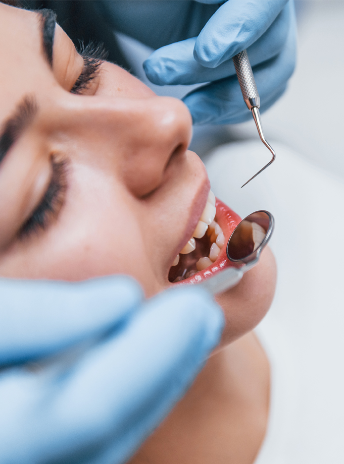 Cavities & Fillings