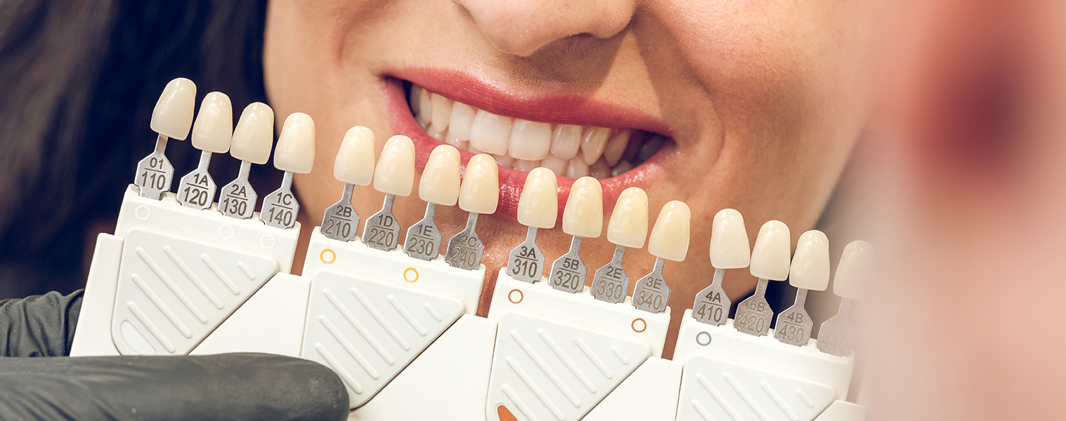 Esthetic Crown Lengthening