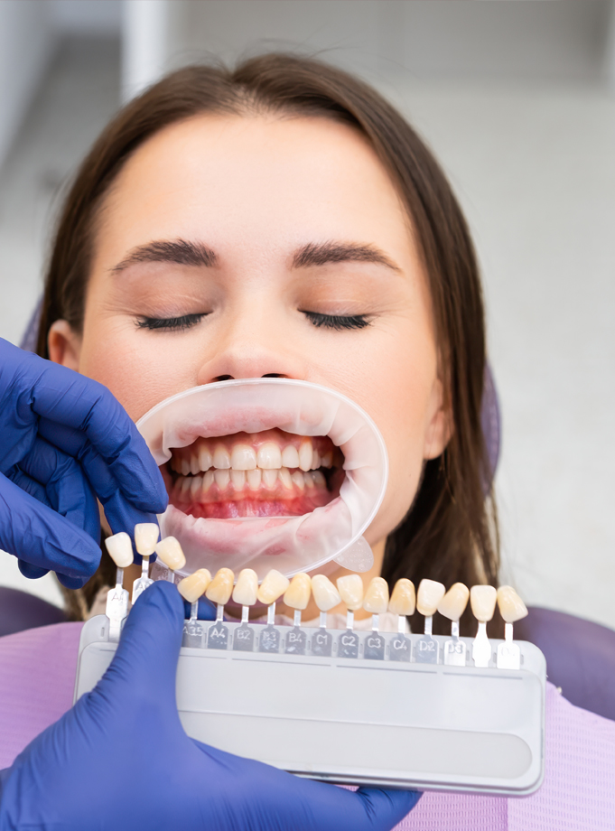 Esthetic Crown Lengthening
