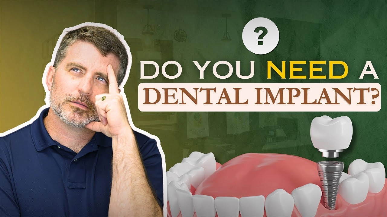 dental implant
