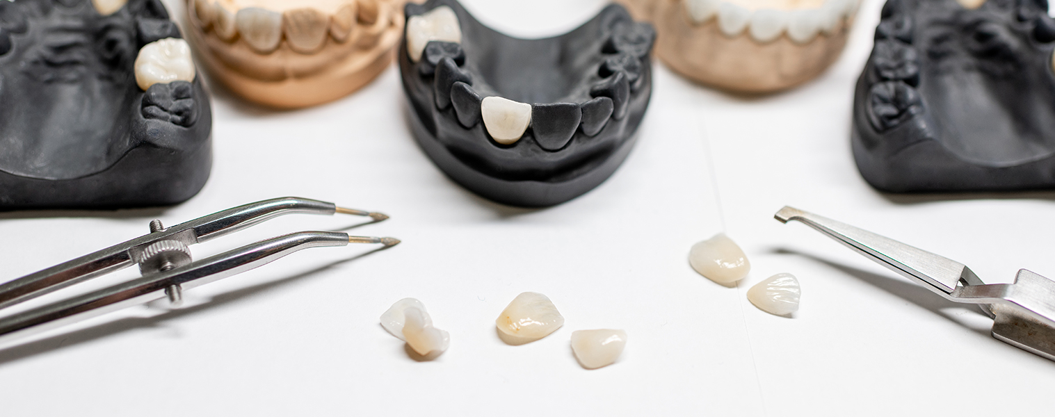 Porcelain Veneers
